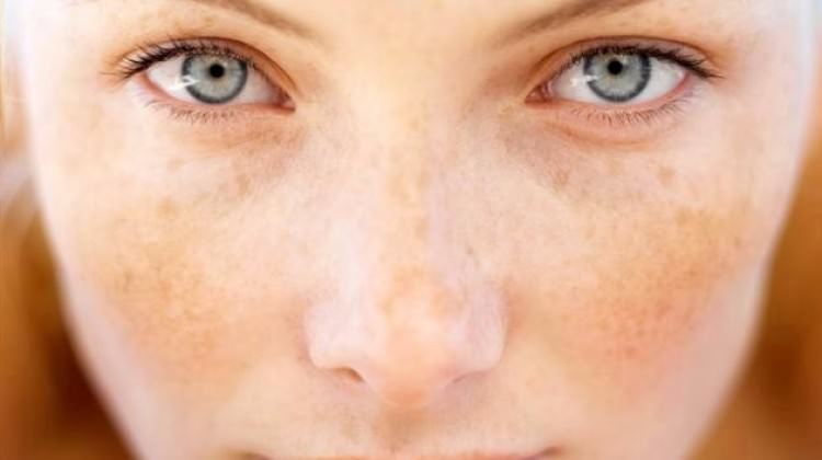 Fransa’da araştırmacılar melanom türü cilt kanserini tedavi edecek bir ilaç