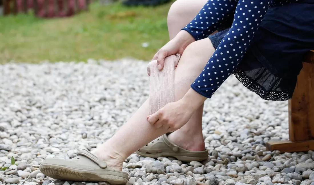 Uzman Diyetisyen Didem Yıldız Küçük konu hakkında bilgiler verdi.  Ödem, damar içi